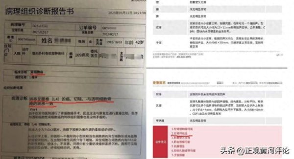 配资门户网站有哪些 评论1+1：女子体检10年未查出癌症，“健康守门人”的失职谁来担责？